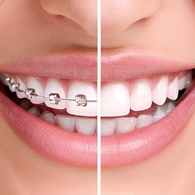 Ortodoncia Oral Care